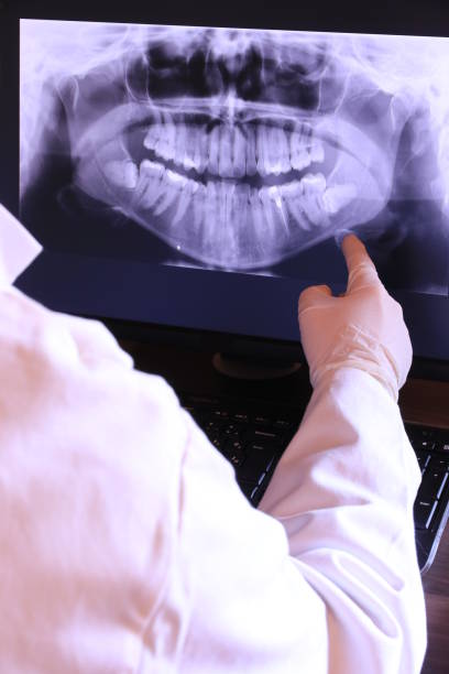 Best Emergency Dental Care for Broken or Chipped Teeth in Mifflinburg, PA